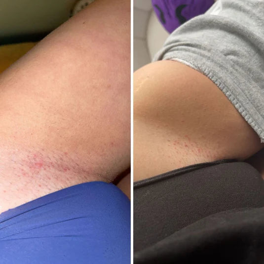 Ingrown Hair + Pre-Post Wax Oil- Nude