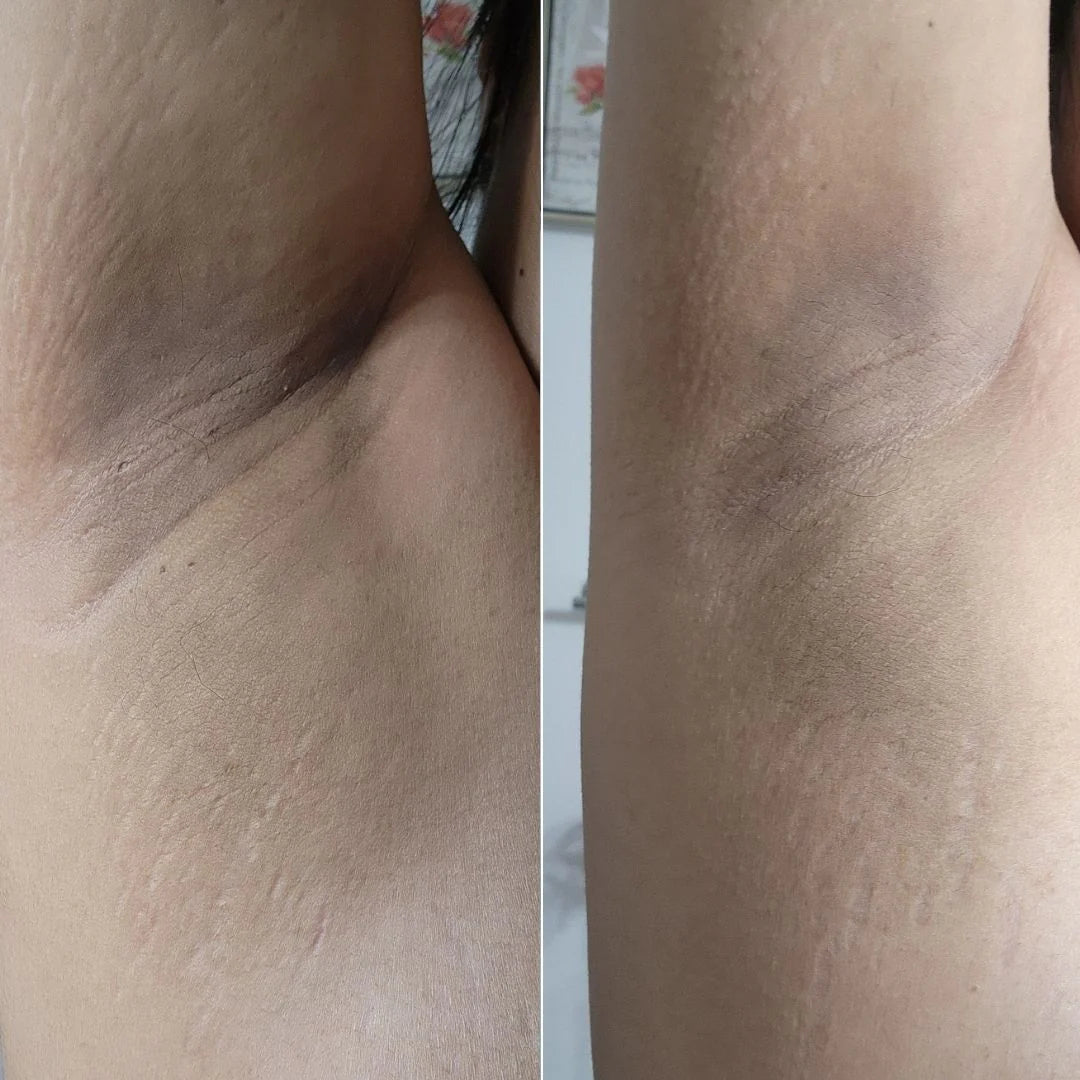 Exfoliating Toner Pads