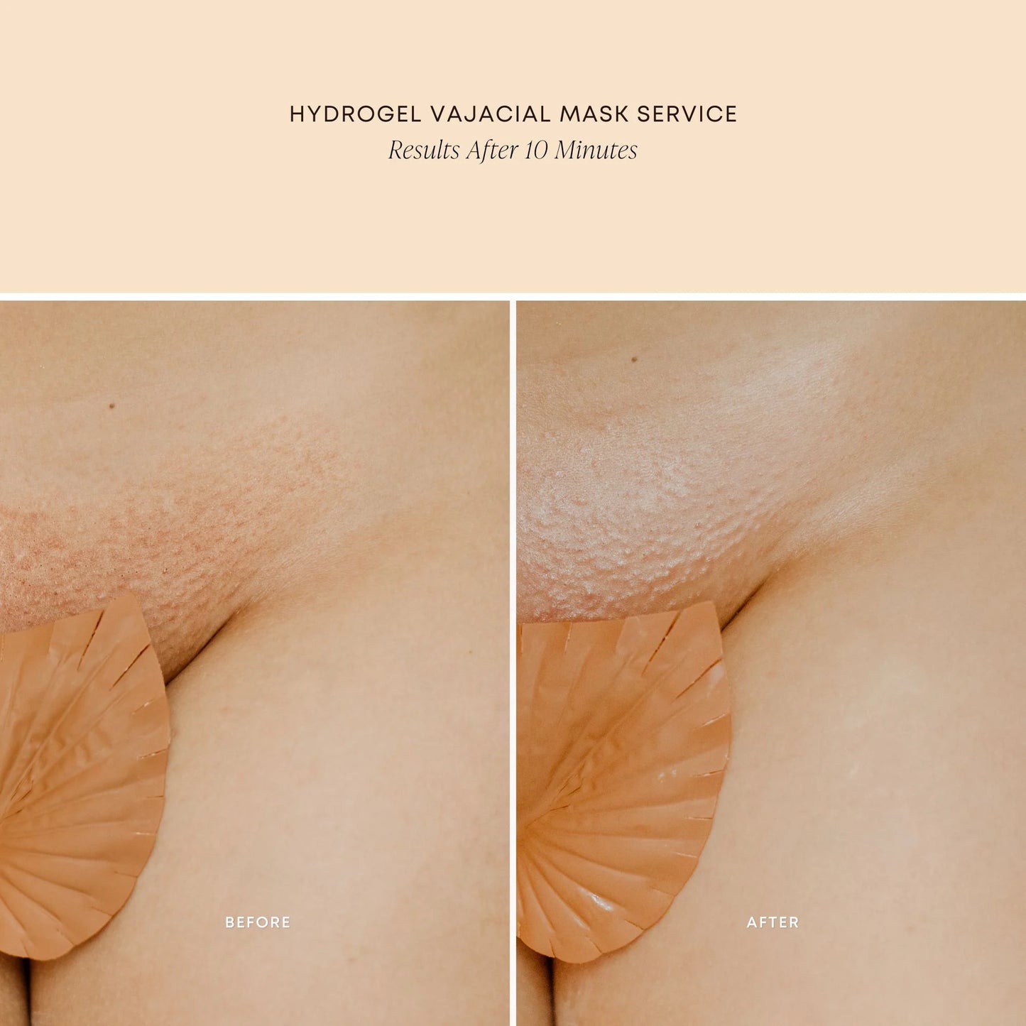 Hydrogel Vajacial Triangle Mask