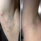 Ingrown Hair Exfoliating Scrub- Nude