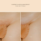 Hydrogel Vajacial Triangle Mask